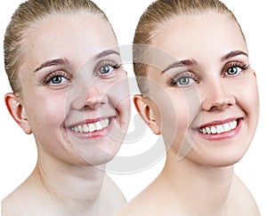 Portrait of woman before and after retouch.