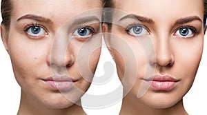 Portrait of woman before and after retouch. photo