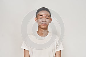 Portrait of young asian man with problematic skin and hyperpigmentation on his face smiling with eyes closed isolated photo
