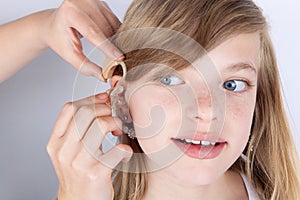 Portrait of a young girl trying hearing aids photo