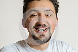 Portrait of a young man with braces smiling. A happy young man with braces on a white background