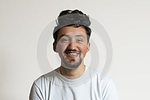 Portrait of a young man with braces smiling and laughing. A happy young man with braces on a white background