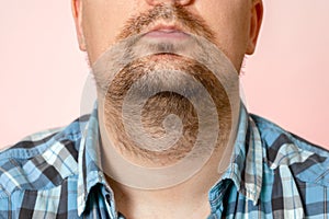 Portrait of young man with unformed, untrimmed, overgrown stubble. Hair on face and neck. Short beard