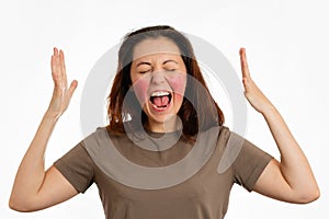 Portrait of a young screaming woman with red inflamed cheeks. White background. The concept of rosacea and couperose photo