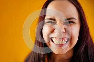 Portrait of young woman with grimacing face. Close up of funny female showing overbite on yellow background.