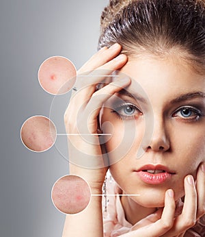 Portrait of young woman with magnifier circles