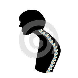 The position of the spine with kyphosis. Black and white silhouette icon. Spinal curvature, kyphosis, lordosis