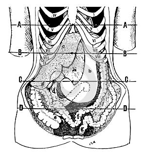 Position of the Viscera in the Condition of Visceroptosis, vintage illustration photo