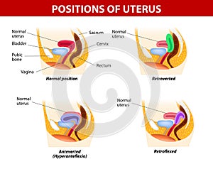 Positions of uterus
