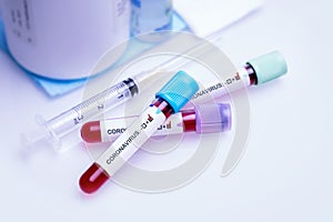 Positive blood test in vacuum tube for the new rapidly spreading Coronavirus COVID-19 biochemical analysis. Coronavirus concept