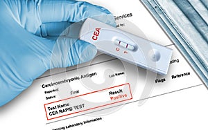 Positive CEA rapid test result by using rapid testing cassette to detect intestinal cancer photo
