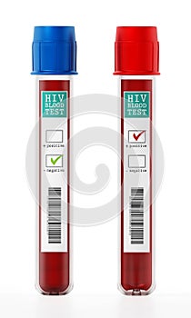 Positive and negative blood samples in vials with HIV test labels. 3D illustration