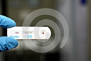 Positive result of HIV AIDS and negative HCV and HBV in a rapid test cassette kit for Hepatitis C virus antibodies HCV AB