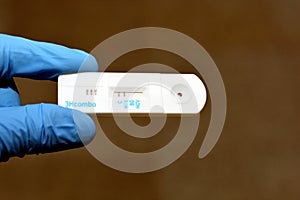 Positive result of HIV AIDS and negative HCV and HBV in a rapid test cassette kit for Hepatitis C virus antibodies HCV AB