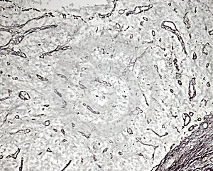 Posterior pituitary. Silver stain for reticular fibers