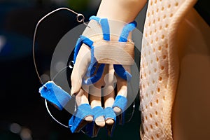 Postoperative bandages for hand on mannequins photo
