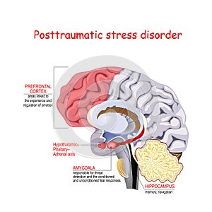 Posttraumatic stress disorder photo