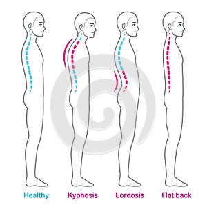 Posture and back problems spine infographic