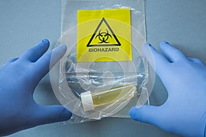 POV human hands in blue plastic gloves with a Biohazard specimen