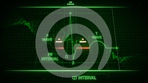 PR and ST Segment from Electrocardiogram Wave or ECG or EKG