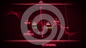 PR and ST Segment from Electrocardiogram Wave or ECG or EKG