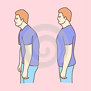 People with impaired posture position defect scoliosis and ideal bearing