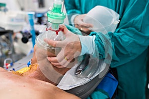 Pre oxygenation for general anesthesia