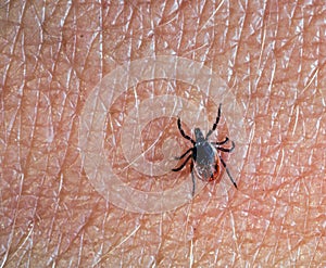 A predatory tick crawls along the human body