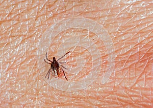 A predatory tick crawls along the human skin. Closeup, top view