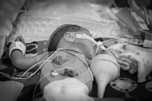 Preemie baby girl in the incubator photo
