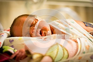 Preemie baby girl sleeping in the incubator photo