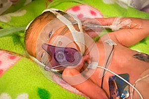 Preemie baby girl sucking on her pacifier photo