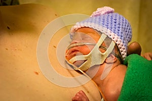Preemie newborn girl skin to skin with dad photo
