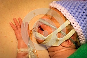 Preemie newborn girl skin to skin with dad photo