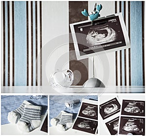 Pregnancy concept collage