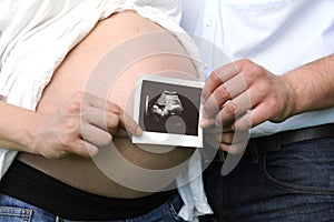 Pregnancy: couple holding ultrasonic image of baby