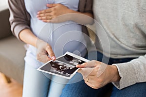 Close up of couple with baby ultrasound images