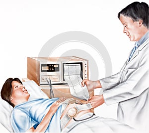 Pregnancy - Fetal Monitoring photo