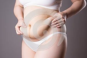 Pregnancy line - linea nigra, tummy tuck, overweight female body and flabby belly on gray background