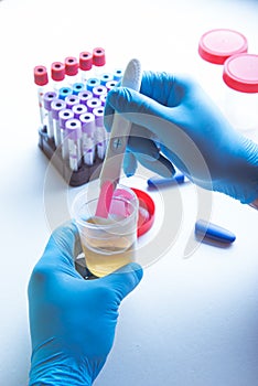 Pregnancy test, HCG laboratory test