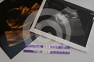 Pregnancy test HCG with photo of baby