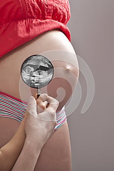 Pregnancy ultrasonic image
