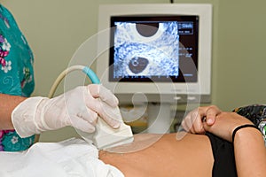 Pregnancy Ultrasound