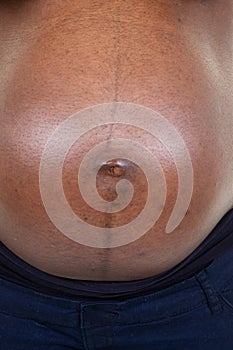 Pregnant African woman belly black tunny closeup