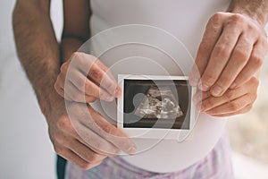 Pregnant couple holding ultrasound scan. Concept of Pregnancy health care
