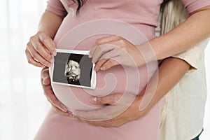 Pregnant couple holding ultrasound scan photo on belly