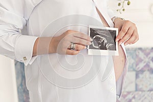 A pregnant woman with a big belly in a white shirt is holding a