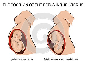 Pregnant woman, child