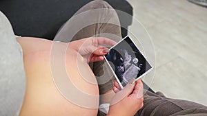 A pregnant woman in comfortable clothes sits on the floor and looks at an ultrasound photo of her baby. Twins. Top view