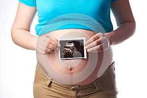 Pregnant woman hold ultrasound scan